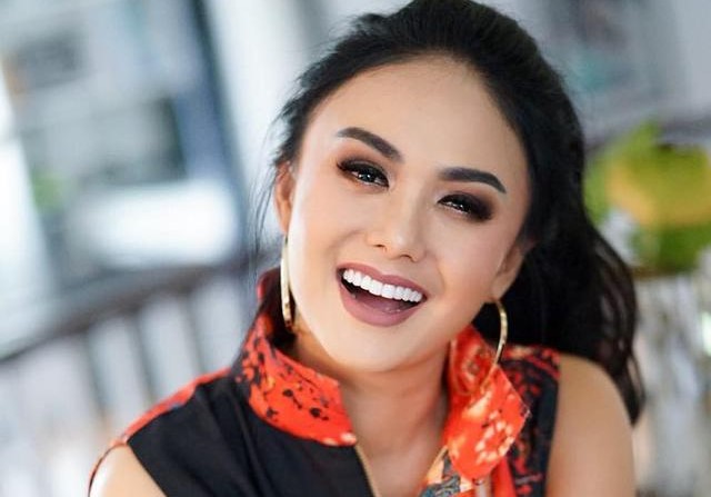Yuni Shara Bantah Hidungnya Mancung, Pipinya Tirus Lantaran Operasi Plastik