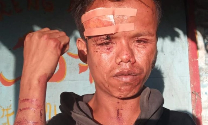 Ketum NPCI Jabar Minta  Usut Tuntas Kasus Pengeroyokan Penyandang Disabilitas di Pangandaran