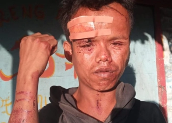 Ketum NPCI Jabar Minta  Usut Tuntas Kasus Pengeroyokan Penyandang Disabilitas di Pangandaran