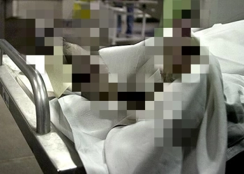 Sempat Dirawat di RS Polri Kramat Jati, Pria Bakar Diri Meninggal 