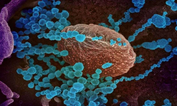 Analisa Respons Imun terhadap Parasetamol dalam Melawan Penyakit Menular Covid-19