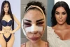 Menyesal, Model Asal Brazil Ini Habiskan 9 Miliar untuk Mirip Kim Kardashian