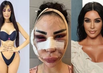 Menyesal, Model Asal Brazil Ini Habiskan 9 Miliar untuk Mirip Kim Kardashian