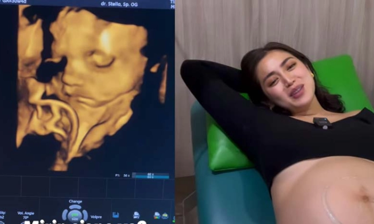 Jessica Iskandar Sampai Lemas Saat Tahu Jabang Bayinya Terlilit Tali Pusar