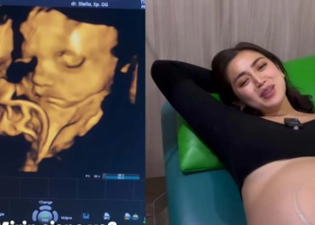 Jessica Iskandar Sampai Lemas Saat Tahu Jabang Bayinya Terlilit Tali Pusar