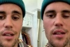 Virus Ini Membuat Separuh Wajah Justin Bieber Lumpuh