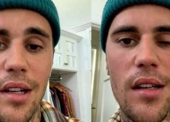 Virus Ini Membuat Separuh Wajah Justin Bieber Lumpuh