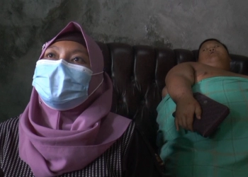 Rafka, Bocah 11 Tahun Menderita Obesitas Hingga 126 Kg