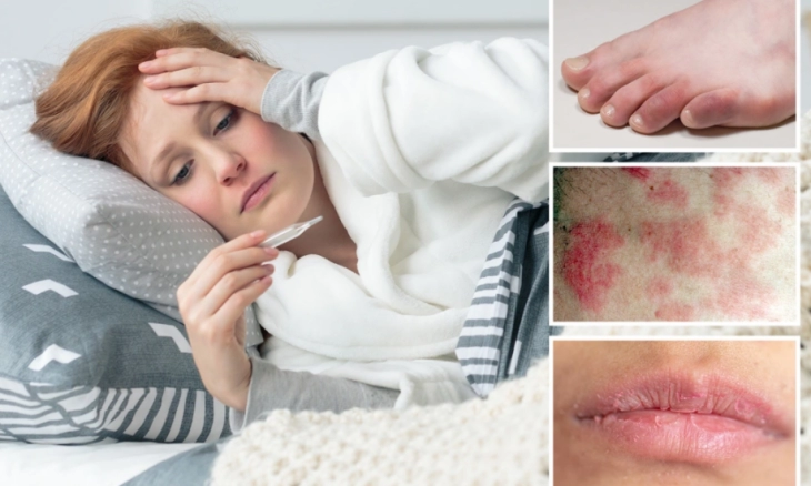 Kenali 6 Gejala Kulit Omicron yang Tak Boleh Anda Abaikan