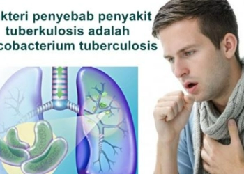Jelang Hari Tuberkulosis, Wapadai Covid-19 dan TBC Bisa Serang Tubuh Bersamaan