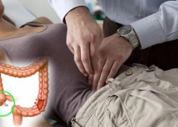 Gejala Kanker Usus: Perut Kembung dan Diare, Jika 3 Pekan Tak Hilang  Segera ke Dokter