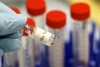 Waspada, Para Ahli Bicara Virus Zika: Ribuan Bayi Alami Kerusakan otak