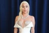 Lady GaGa Jalani Prosedur Permak Wajah dari Mulai Botox, Pasang Benang hingga Suntik neuromodulator 