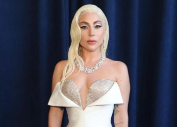 Lady GaGa Jalani Prosedur Permak Wajah dari Mulai Botox, Pasang Benang hingga Suntik neuromodulator 