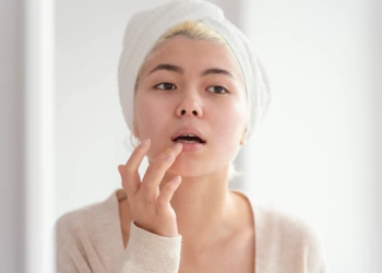 Atasi Bibir Kering dengan Madu
