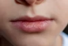 Cara Mudah Merawat Bibir Kering dan Pecah-pecah
