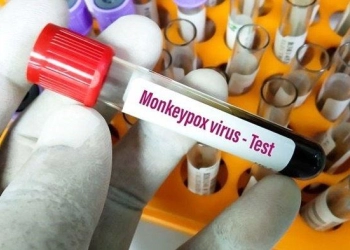 Wabah Cacar Monyet, Masyarakat Diimbau untuk Tidak Panik dan Tetap Waspada