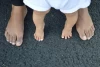 Penyebab dan Cara Mencegah Kaki O Pada Bayi 