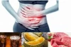 Waspada! Ternyata Makanan Favorit Ini Penyebab Penyakit Kista Ovarium Pada Wanita