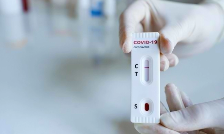 Misteri Medis, Orang Mati Tetap Positif Covid Selama Lebih dari Sebulan