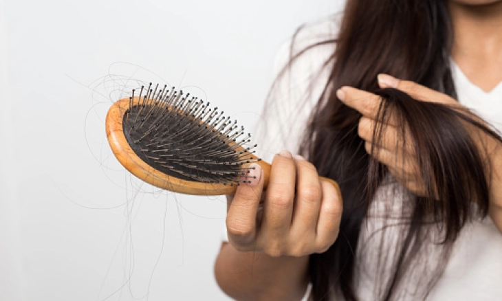 Waspadai Penyebab Rambut Rontok