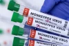 Cegah Pelanggaran, WHO Sebut Monkeypox sebagai Clades I, IIa dan IIb