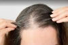 Mencegah Rambut Beruban Prematur Secara Alami