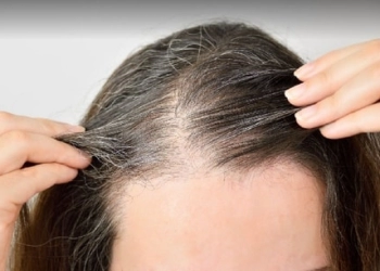Mencegah Rambut Beruban Prematur Secara Alami